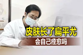 皮肤长了扁平疣，会自己痊愈吗