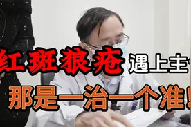 孩子面部长斑，突然发烧，一查竟是红斑狼疮，主任：放心我很专业视频封面