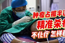 广东肺癌阿叔坚决不做化疗，不长期住院！植入杀癌粒子，隔天出院视频封面