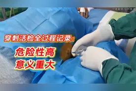 穿刺活检全过程记录：危险性高，但对诊断肿瘤良恶性，极其重要！