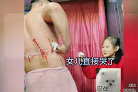 父亲因演出受伤，女儿心疼到落泪帮爸爸擦药，网友：这闺女值了！视频封面