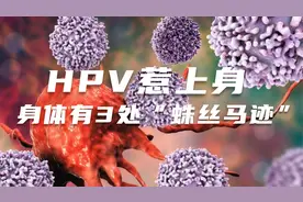 HPV惹上身，身体有3处“蛛丝马迹”视频封面