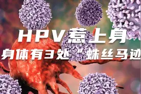 HPV惹上身，身体有3处“蛛丝马迹”视频封面