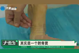 骨折后脚踝疼不能走路，医生“一针透两穴”缓解病痛