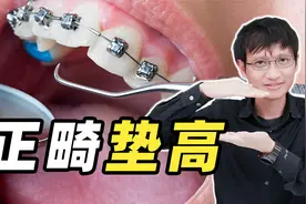 矫正牙齿为什么要垫高？有什么作用？视频封面