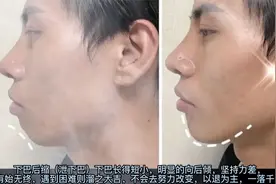 观相识人“下巴后缩（泄下巴）”！视频封面