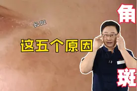 眼角长斑的5个原因！视频封面