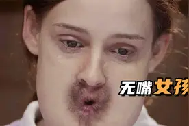 女孩没有嘴，脸上长菊花视频封面