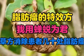 脂肪瘤的“特效方”，我用蝉蜕为君，草方消除患者身上多处脂肪瘤视频封面