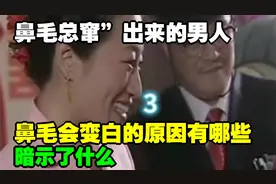 鼻毛总窜”出来的男人，暗示了什么？鼻毛会变白的原因有哪些？