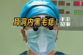凸起且容易摩擦部位的痣，最好是处理，摩擦次数多又伴随增大，后面的情况就不好把控！ #黑毛痣  #去痣  #医生日常 视频封面