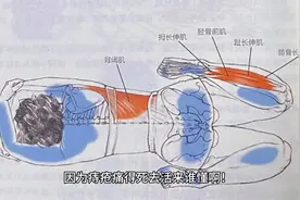 痔疮学会青蛙趴，才一个月就好了！