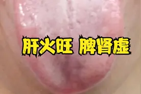 舌边鼓胀还发红，说明肝火旺和脾肾虚，调理顺序才是重点！视频封面