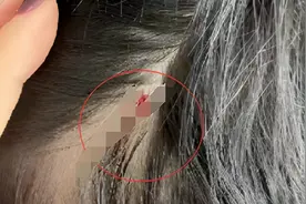 郑州一小学生被老师打破头？教育局：正调查视频封面