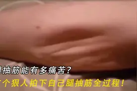 腿抽筋能有多痛苦？这个狠人强忍疼痛拍下自己腿抽筋全过程！视频封面