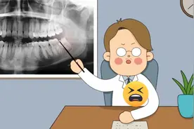 ASMR：沉浸式拔智齿 解压动画之拔智齿