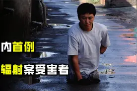 核辐射到底有多可怕？上班路上捡到金属链，十小时后被截去双腿视频封面