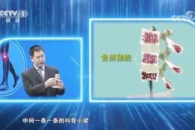 【为什么会出现骨质疏松？专家结合脊柱模型现场讲解视频封面