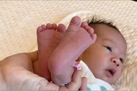 宝宝得了红屁股 热疹 湿疹 怎么办？！欧阳妈妈教你快速解决