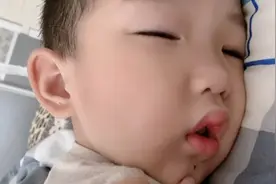 儿子下巴的痣有人说是发财痣，有人说是君王痣，纠结到底要不要点