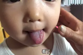 2岁甜甜舌头少一块肉，地瓜和丽丽吓得赶紧去医院查，啥情况？视频封面