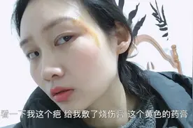 车祸后的第三次激光祛疤，医生说半年后疤痕才会慢慢淡化，很惆怅视频封面