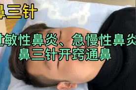 靳三针：过敏性鼻炎、急慢性鼻炎等鼻塞流涕，针灸有奇招！视频封面