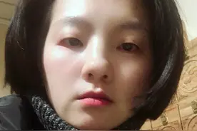 雄激素高会导致脱发吗？我来告诉你视频封面