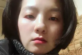 雄激素高会导致脱发吗？我来告诉你视频封面