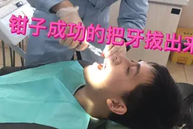 美女牙医姐姐用铁钳给老公拔牙，懒懒看着又生气又心疼，悲哀！视频封面