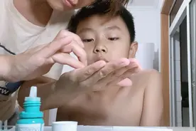 八岁儿子近视，控制度数增长，我们选择角膜塑形镜，第八天视频封面