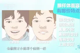 【孩子容貌“变丑”也是病？可能是这样原因！[灵光一闪]视频封面