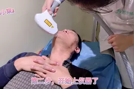 小柒今天陪爸爸去美容院做冰点络腮胡脱毛，做完效果特别好。视频封面