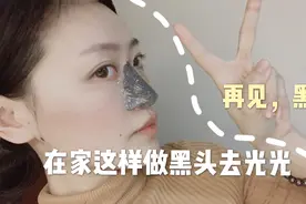 高端美容院的去黑头方法 在家也能做 黑头去的一样干净