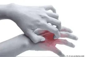 湿疹为什么那么痒而不是疼呢？一文揭开湿疹的秘密以及解决方法图片