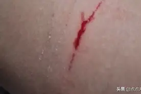 点点，把妈妈抓了，一定要剪指甲了。剪剪剪图片
