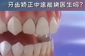 牙齿矫正中途能换医生吗？