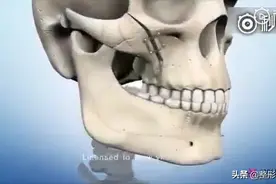 3D动画演示韩国整容术视频封面