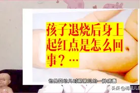 孩子退烧后身上起红点是怎么回事？原来是幼儿急疹视频封面