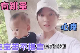 16个月宝宝被跳蚤咬的浑身是包，宝妈急忙上街买药擦，可心疼了