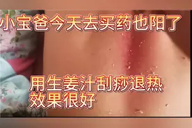 小宝爸今天去镇上买药也阳了，回来就烧到37.8，给他刮痧退烧