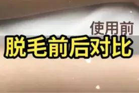 脱毛真的能永久不长吗？教你这个方法，让汗毛越来越少，夏季变美视频封面