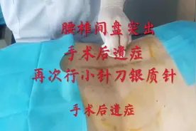 腰椎间盘突出手术后症状没有改善，再行小针刀银质针@西瓜健康视频封面