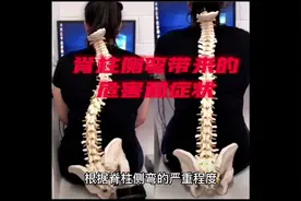 脊椎侧弯带来的危害和症状视频封面