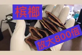 把槟榔放大800倍，看完你还敢吃吗？我反正是不敢吃了？视频封面
