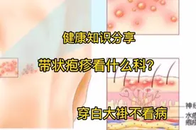 带状疱疹看什么科？视频封面