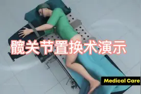 全髋关节置换手术演示，一看就懂！视频封面
