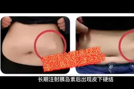 长期注射胰岛素腹部出现硬块怎么办？视频封面