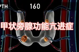 精品医学动画:甲状旁腺功能亢进是怎么回事？视频封面