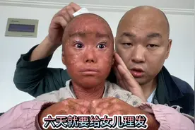 濛濛头上不舒服了有点刺挠，需要爸爸给我理光头了。视频封面